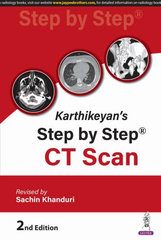 Karthikeyan's Step by Step CT Scan, 2nd Edition (PB)