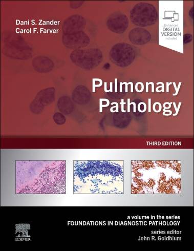 Pulmonary Pathology : A Volume in the Foundations in Diagnostic Pathology Series, 3e