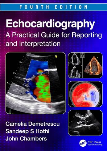 Echocardiography: A Practical Guide for Reporting and Interpretation by Camelia Demetrescu, 4e (PB)