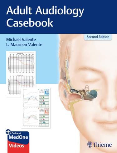 Adult Audiology Casebook by Valente: 2/e