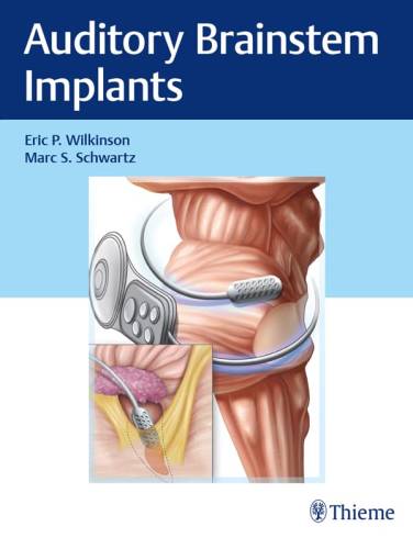 Auditory Brainstem Implants by Eric P. Wilkinson (HB)