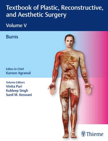 Textbook of Plastic, Reconstructive, and Aesthetic Surgery: Volume
V: Burns: 1/e
