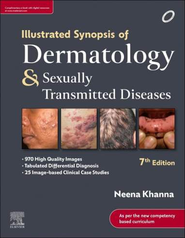 9788131266991 Illustrated Synopsis of Dermatology and Sexually Transmitted Diseases, 7e by Neena Khanna